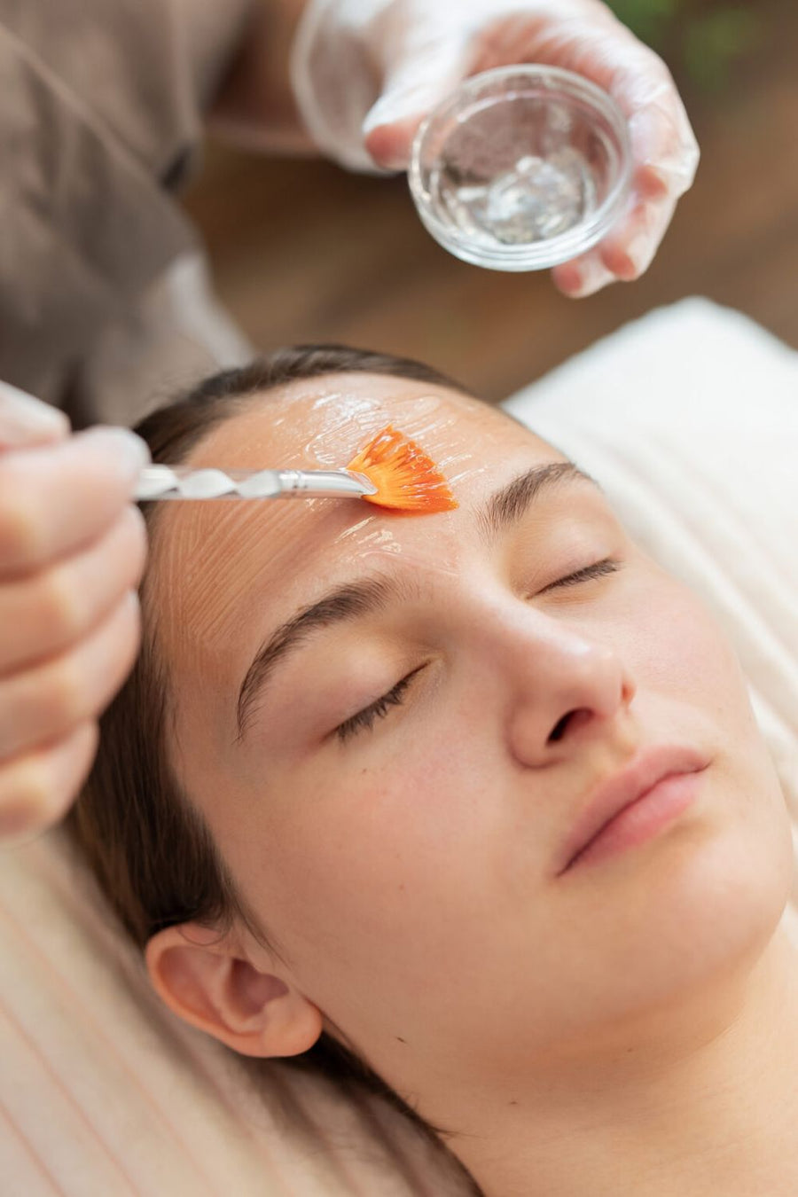 Chemical Peel treatment at Allodermis — AIIMS MD dermatologist clinic in India