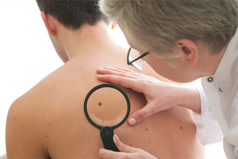 Skin Biopsy Procedure procedure step-by-step at Allodermis dermatology clinic