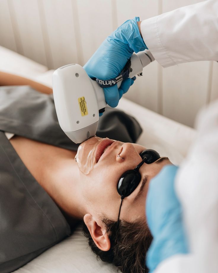 Laser Hair Removal treatment at Allodermis — AIIMS MD dermatologist clinic in India