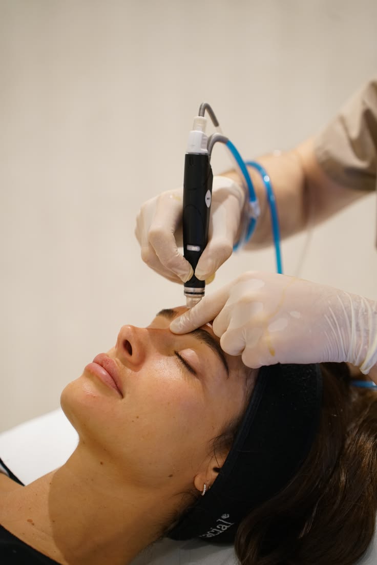 Laser Toning procedure step-by-step at Allodermis dermatology clinic