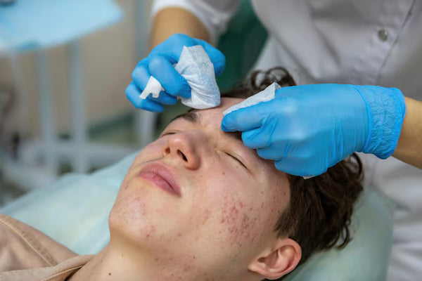 Pimples Treatment