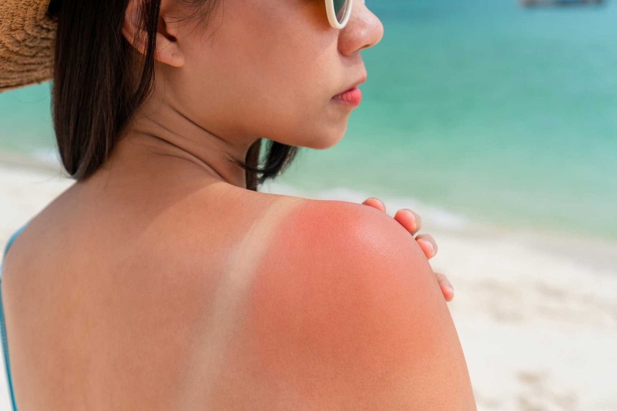 How to Remove Sun Tan From Your Face: A Dermatologist's 4-Week Home Plan — Allodermis dermatology clinic