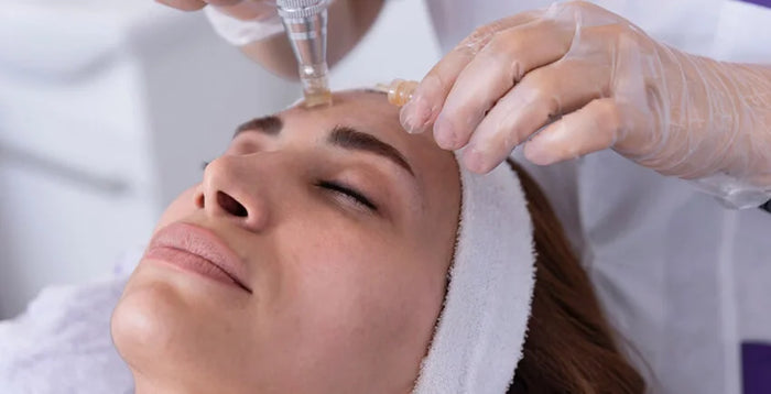 PRP with Microneedling near Patia College Road, Bhubaneswar — For Young Skin Left With Acne Scars