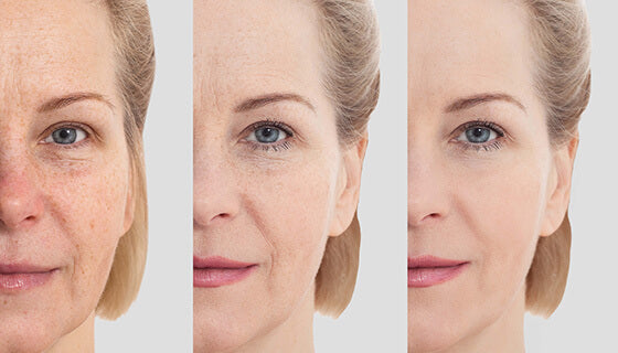 Facial Rejuvenation: Benefits and What to Expect