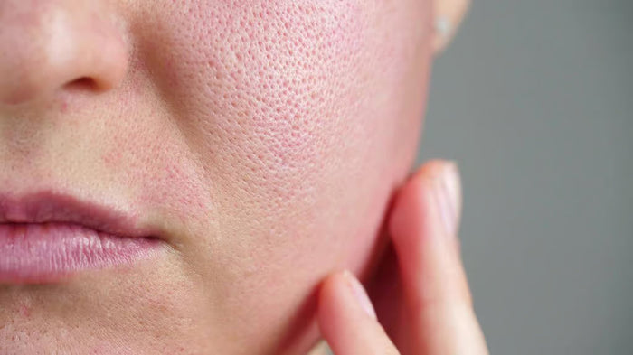 Open Pores Treatment Explained: Causes, What Actually Works, Best Procedures, Timelines, and Prevention