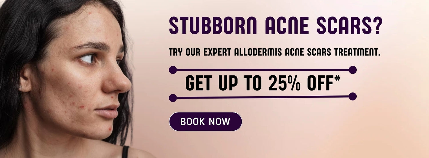 Allodermis