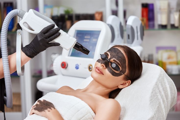 Carbon Laser Peel procedure step-by-step at Allodermis dermatology clinic