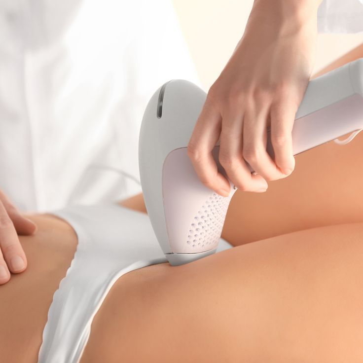 What is Laser Bikini hair removal — dermatologist explanation at Allodermis