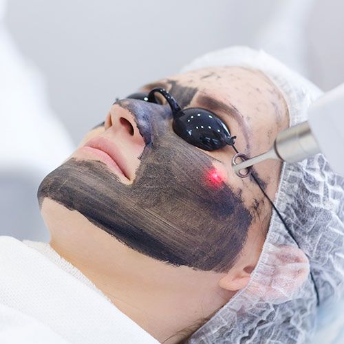 Black Peel treatment treatment at Allodermis — AIIMS MD dermatologist clinic in India