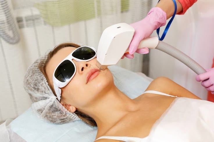 Facial hair Removal treatment at Allodermis — AIIMS MD dermatologist clinic in India