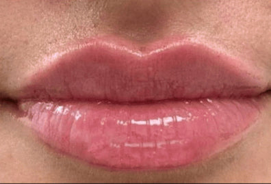 After: Thin Lips