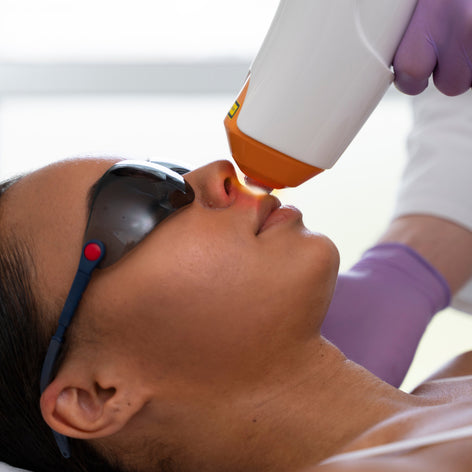 Laser Facial Hair Removal