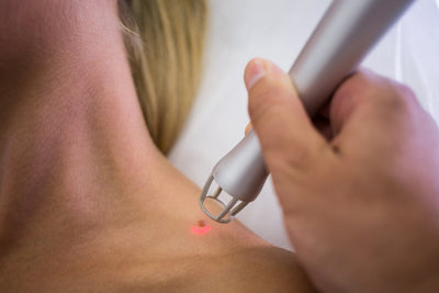 Skin Biopsy
