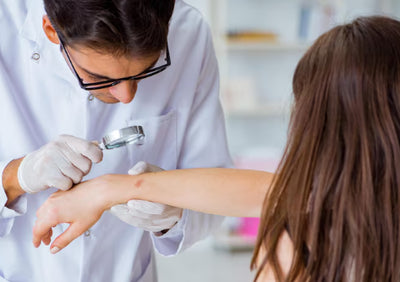 Allergy & Patch Test